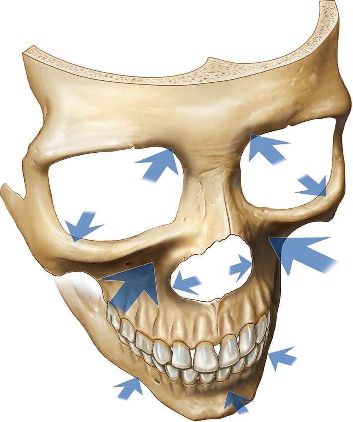 aging 
facial skeleton