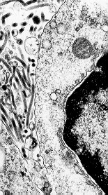 Electron Micrograph of 
the Ebola virus