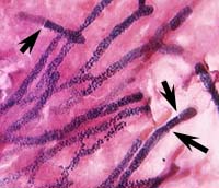 Aspergillus hyphae