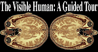 Visible Human