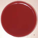 Chocolate Agar