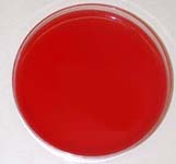 5% Sheep's Blood Agar